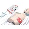 Mediana A16 HeartOn Aed Fully Automatic Defbrillator